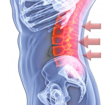 Bauchmuskeltraining für einen gesunden Rücken